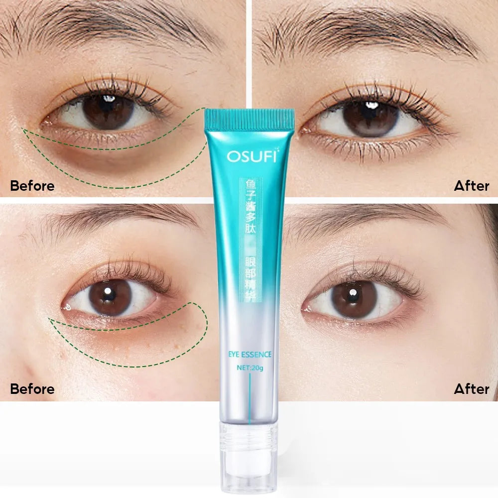 7 Days Anti-Wrinkle Eye Cream